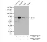 IGF2BP3 Antibody in Immunoprecipitation (IP)