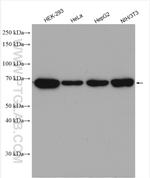 IGF2BP3 Antibody in Western Blot (WB)