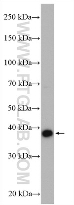 RDH10 Antibody in Western Blot (WB)