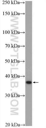 RDH10 Antibody in Western Blot (WB)