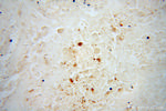 BIN1 Antibody in Immunohistochemistry (Paraffin) (IHC (P))