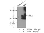 BIN1 Antibody in Immunoprecipitation (IP)