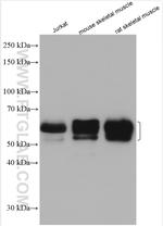 BIN1 Antibody in Western Blot (WB)