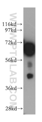 BIN1 Antibody in Western Blot (WB)