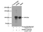 POSH Antibody in Immunoprecipitation (IP)