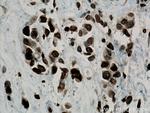 LAP2 Antibody in Immunohistochemistry (Paraffin) (IHC (P))