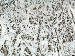 LAP2 Antibody in Immunohistochemistry (Paraffin) (IHC (P))