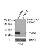 LAP2 Antibody in Western Blot (WB)