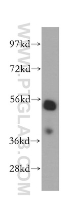 LAP2 Antibody in Western Blot (WB)