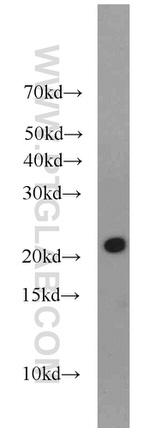 ARPC3 Antibody in Western Blot (WB)