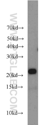 ARPC3 Antibody in Western Blot (WB)