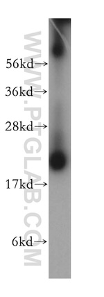 ARPC3 Antibody in Western Blot (WB)