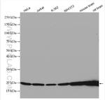 ARPC3 Antibody in Western Blot (WB)