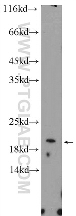 EIF1AX Antibody in Western Blot (WB)