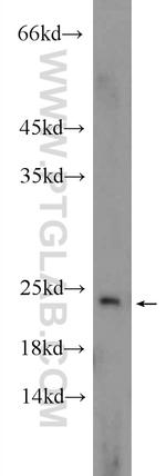 EIF1AX Antibody in Western Blot (WB)