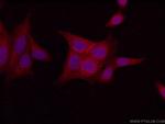 LIN7C Antibody in Immunocytochemistry (ICC/IF)