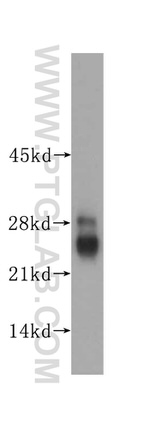 LIN7C Antibody in Western Blot (WB)