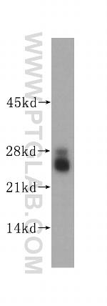 LIN7C Antibody in Western Blot (WB)