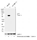 alpha-Fetoprotein Antibody in Western Blot (WB)