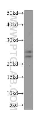 PHLDA2 Antibody in Western Blot (WB)