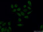 AFF4 Antibody in Immunocytochemistry (ICC/IF)