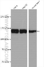 AFF4 Antibody in Western Blot (WB)