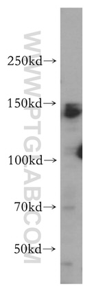 AFF4 Antibody in Western Blot (WB)