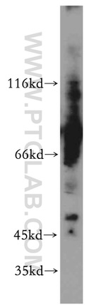 ELK4 Antibody in Western Blot (WB)
