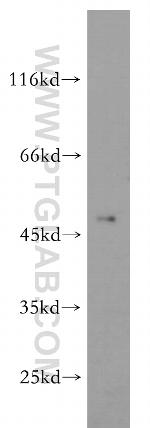 ELK4 Antibody in Western Blot (WB)