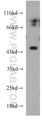 ELK4 Antibody in Western Blot (WB)