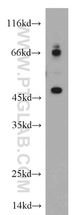 ELK4 Antibody in Western Blot (WB)