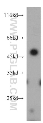 ELK4 Antibody in Western Blot (WB)