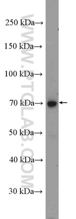 Decorin Antibody in Western Blot (WB)