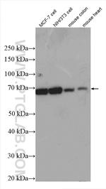 Decorin Antibody in Western Blot (WB)