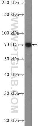 Decorin Antibody in Western Blot (WB)