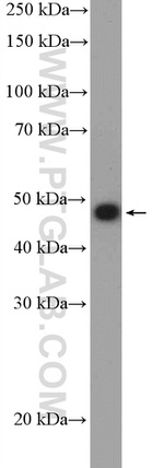 Decorin Antibody in Western Blot (WB)