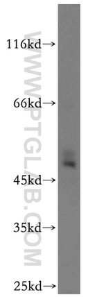 SLC25A24 Antibody in Western Blot (WB)