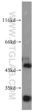 SLC25A24 Antibody in Western Blot (WB)