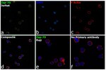 Zap-70 Antibody