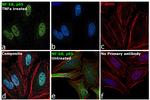 NFkB p65 Antibody in Immunocytochemistry (ICC/IF)