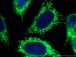 ATP5A1 Antibody in Immunocytochemistry (ICC/IF)