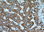 ATP5A1 Antibody in Immunohistochemistry (Paraffin) (IHC (P))