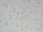 ATP5A1 Antibody in Immunohistochemistry (Paraffin) (IHC (P))