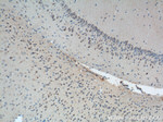 ATP5A1 Antibody in Immunohistochemistry (Paraffin) (IHC (P))