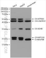 ATP5A1 Antibody in Western Blot (WB)