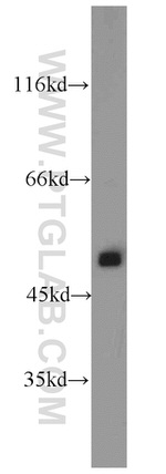 ATP5A1 Antibody in Western Blot (WB)