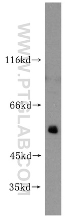 ATP5A1 Antibody in Western Blot (WB)