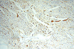 IgG light chain (Kappa) Antibody in Immunohistochemistry (Paraffin) (IHC (P))