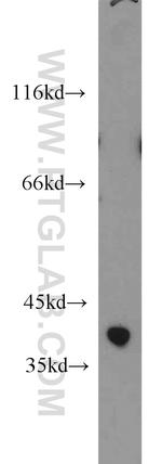 ZADH2 Antibody in Western Blot (WB)