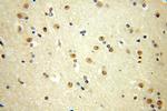 MTA3 Antibody in Immunohistochemistry (Paraffin) (IHC (P))